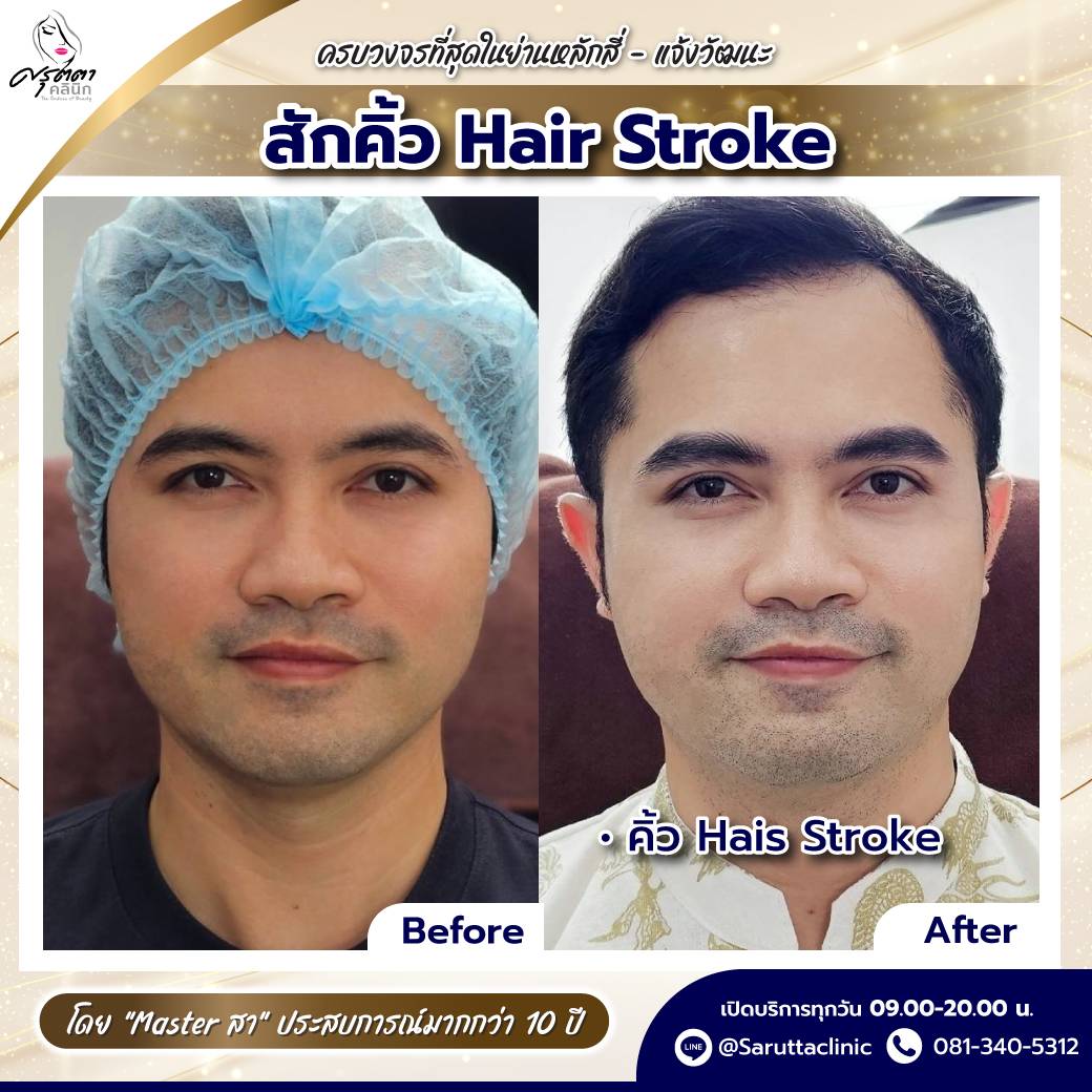 สักคิ้ว