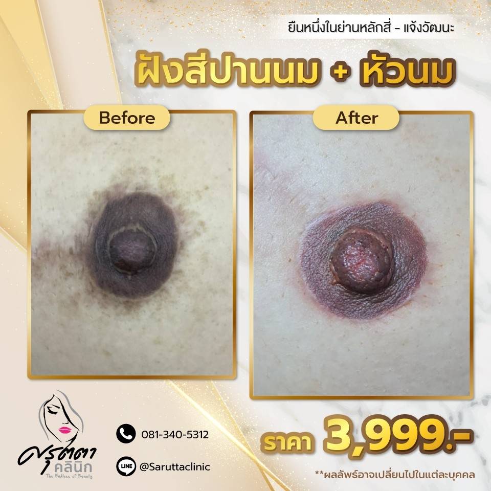 สักปานนม
