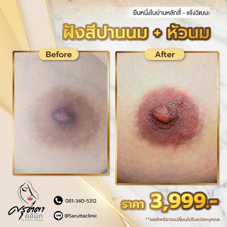 สักปานนม