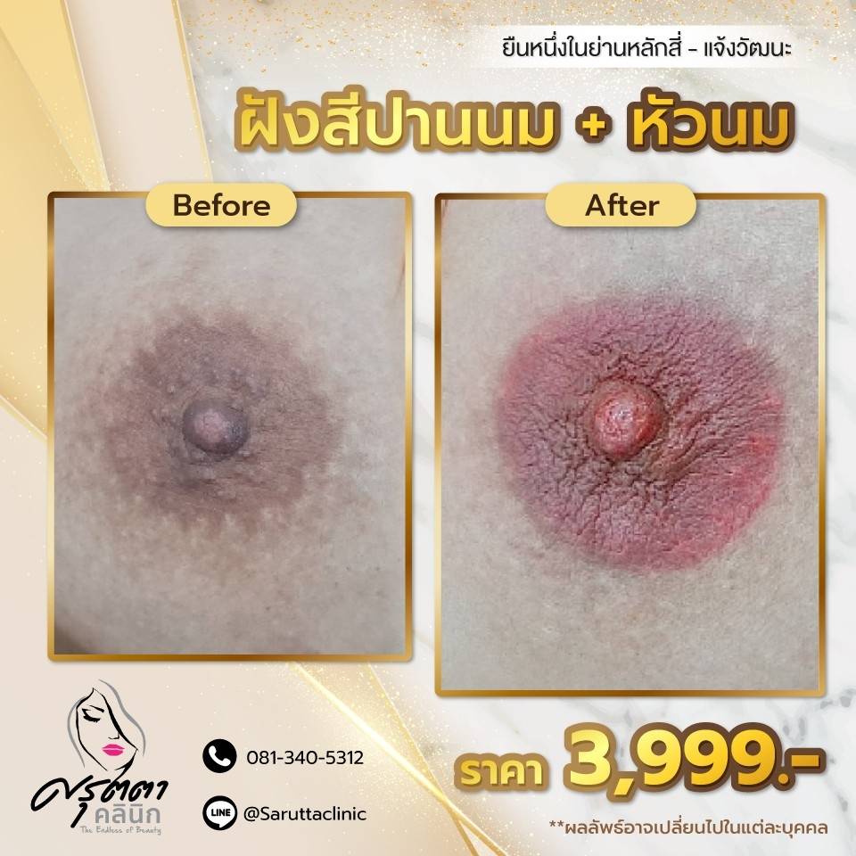 สักปานนม