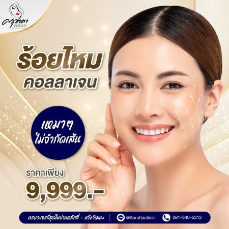 ร้อยไหม